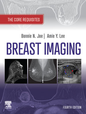 cover image of Breast Imaging